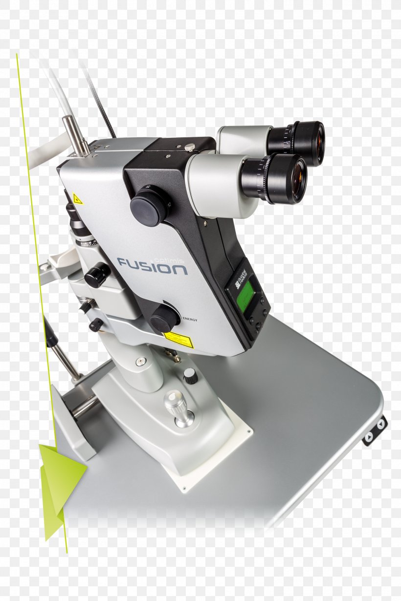 Nd:YAG Laser Laser Surgery Yttrium Aluminium Garnet Trabeculoplasty Q-switching, PNG, 1500x2250px, Ndyag Laser, Angle Grinder, Cataract, Glaucoma, Hardware Download Free