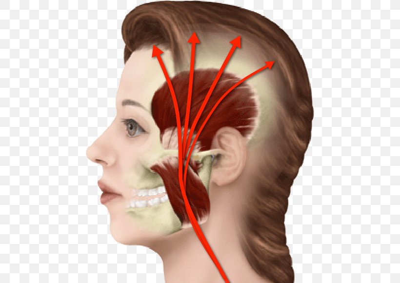 Myofascial Pain Syndrome Neck Pain Orofacial Pain Headache Face, PNG, 469x580px, Myofascial Pain Syndrome, Ache, Cheek, Chin, Chiropractic Download Free