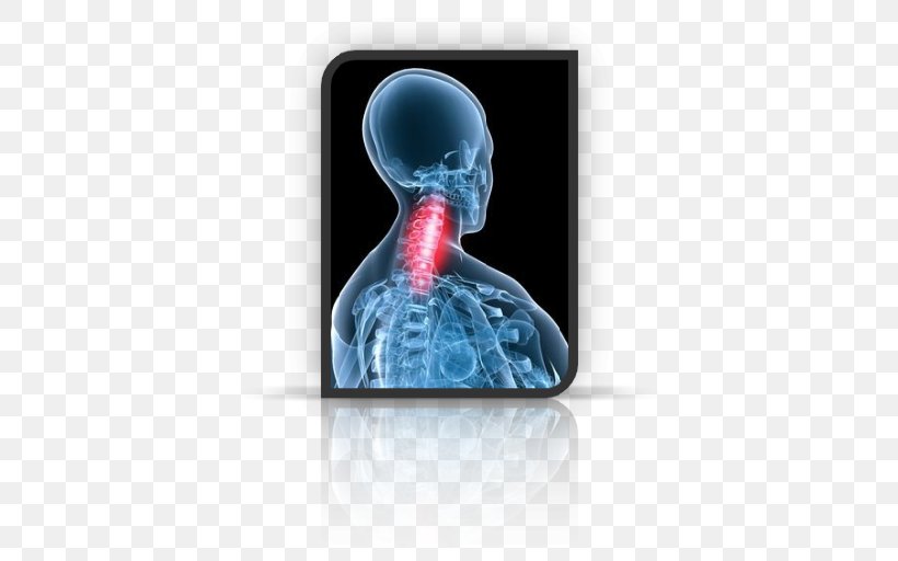 Neck Pain Riluzole Drug Osteochondrosis, PNG, 512x512px, Neck Pain, Ache, Amyotrophic Lateral Sclerosis, Disease, Drug Download Free