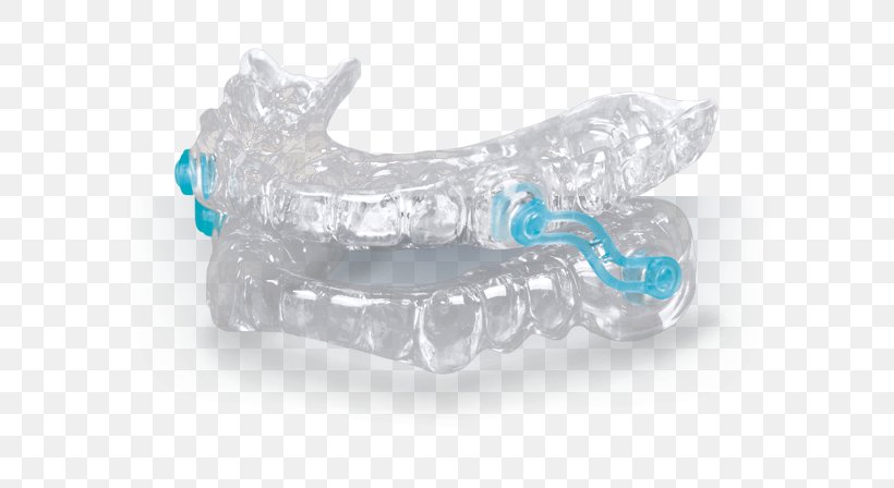 Mandibular Advancement Splint Snoring Sleep Apnea Dentistry, PNG, 600x448px, Mandibular Advancement Splint, Apnea, Aqua, Blue, Bruxism Download Free