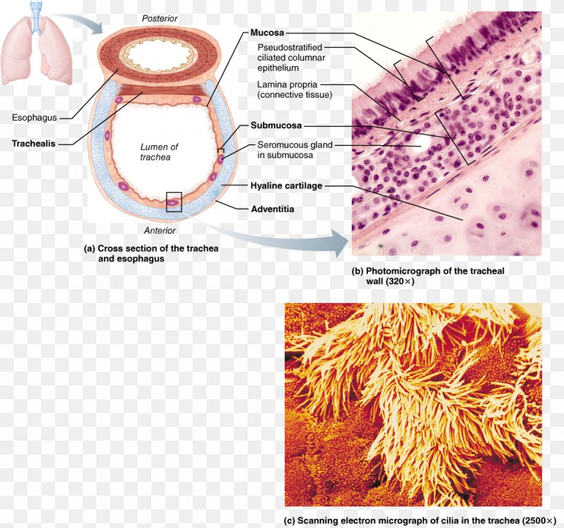 trachea slide labeled