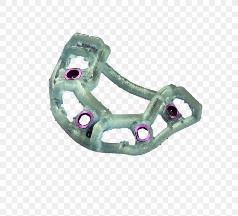 Body Jewellery Computer Hardware Clothing Accessories Dental Implant, PNG, 1389x1262px, Body Jewellery, Body Jewelry, Clothing Accessories, Computer Hardware, Dental Implant Download Free