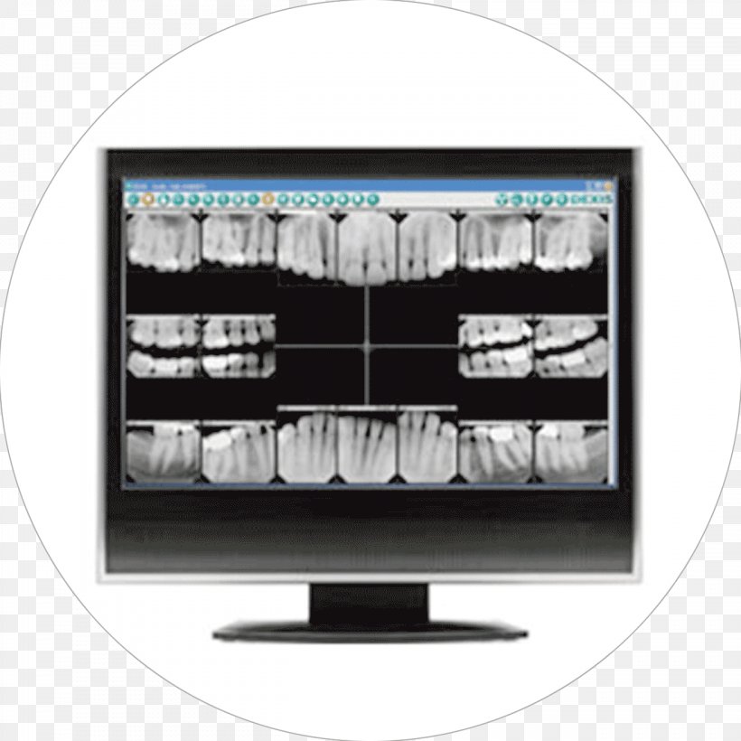 Dentistry Digital Radiography Tooth, PNG, 1312x1312px, Dentistry, Brand, Dental Radiography, Dentist, Digital Radiography Download Free