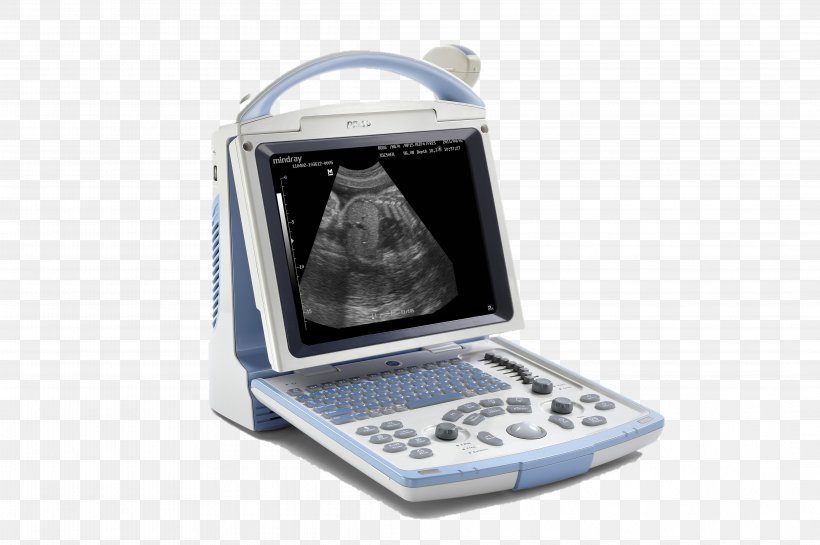 Ultrasonography Mindray Ultrasound Medicine Doppler Echocardiography, PNG, 4256x2832px, Ultrasonography, Doppler Echocardiography, Electronic Device, Health, Health Care Download Free