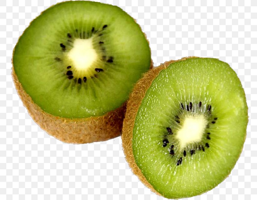 Kiwifruit Diabetes Mellitus Auglis Blood Sugar, PNG, 772x638px, Kiwifruit, Auglis, Blood Sugar, Diabetes Mellitus, Diet Download Free