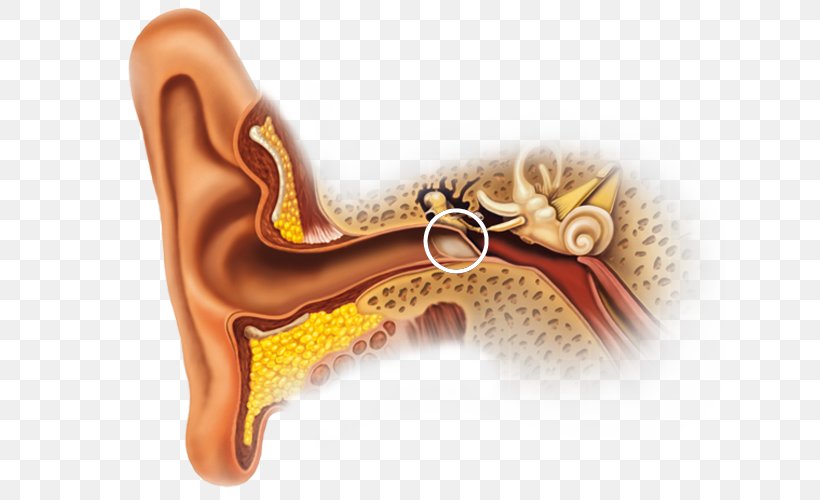 Earwax Inner Ear Ear Canal Outer Ear, PNG, 633x500px, Watercolor, Cartoon, Flower, Frame, Heart Download Free