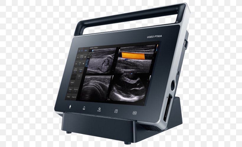 Ultrasonography Samsung Electronics Ultrasound Medicine, PNG, 500x500px, Ultrasonography, Contrast Resolution, Display Device, Electronics, Imaging Technology Download Free
