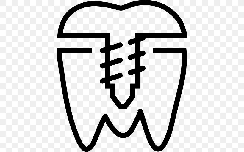 Dental Implant Dentistry Dentures, PNG, 512x512px, Dental Implant, Area, Black, Black And White, Brand Download Free