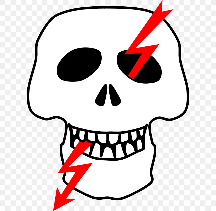 Electrical Injury Electricity Symbol Clip Art, PNG, 800x800px, Electrical Injury, Artwork, Black And White, Bone, Cheek Download Free