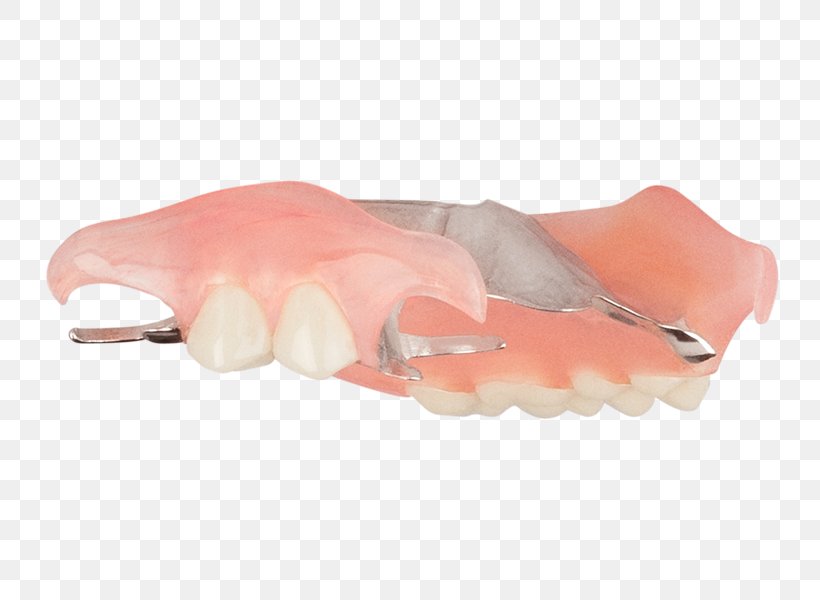 Dentures Removable Partial Denture Tooth Dentistry Home Improvement, PNG, 749x600px, Dentures, Aspen Dental, Bathroom, Bedroom Floor, Dentistry Download Free