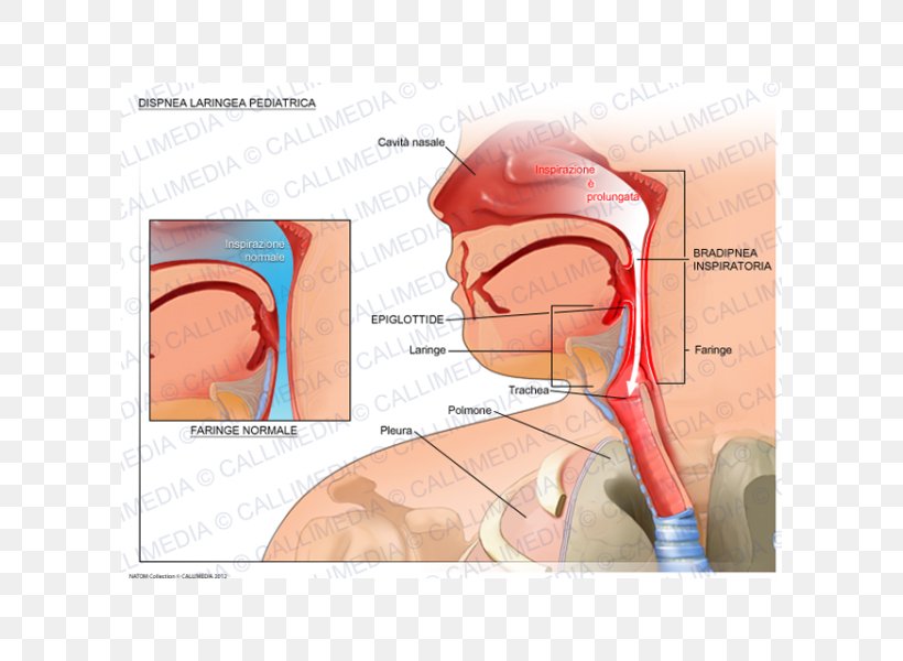 The Nightmare Ear Dyspnea Larynx Medicine, PNG, 600x600px, Watercolor, Cartoon, Flower, Frame, Heart Download Free