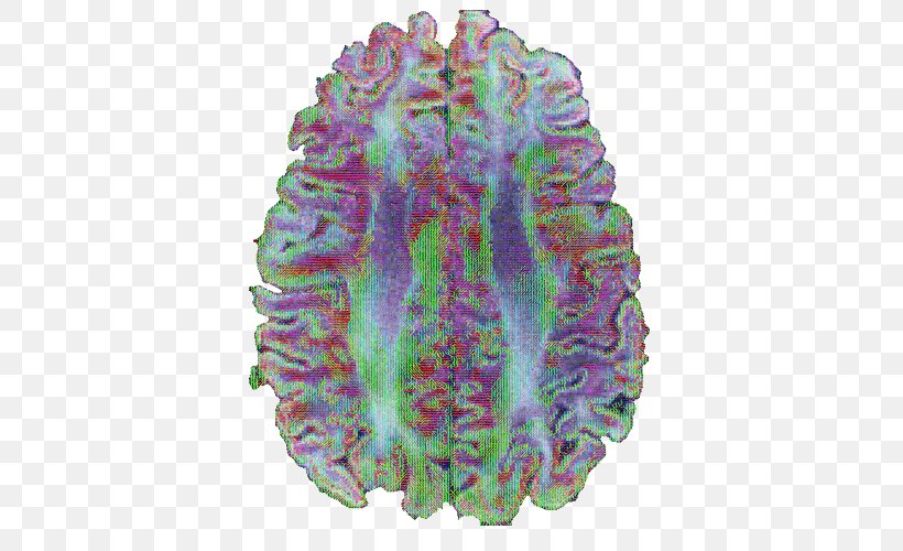 Brain Purple Medicine, PNG, 500x500px, Brain, Coral, Medical, Medicine, Organism Download Free