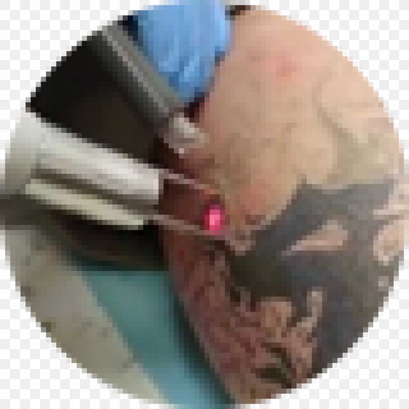 Tattoo Removal Tattoo Artist Permanent Makeup Laser, PNG, 1024x1024px, Tattoo Removal, Beauty Parlour, Body Piercing, Cosmetics, Cream Download Free