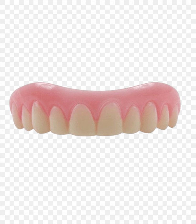 Human Tooth Dentures Veneer Dentistry, PNG, 1312x1500px, Tooth, Cosmetic Dentistry, Dental Braces, Dentist, Dentistry Download Free