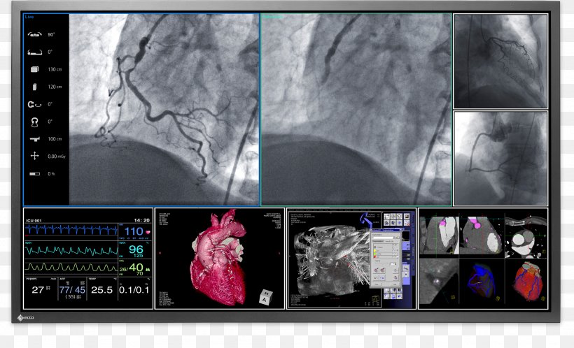 Medical Imaging Computer Monitors Eizo Nanao EIZO RadiForce MX191 Surgery, PNG, 2051x1247px, 4k Resolution, Medical Imaging, Collage, Computer Monitors, Dicom Download Free