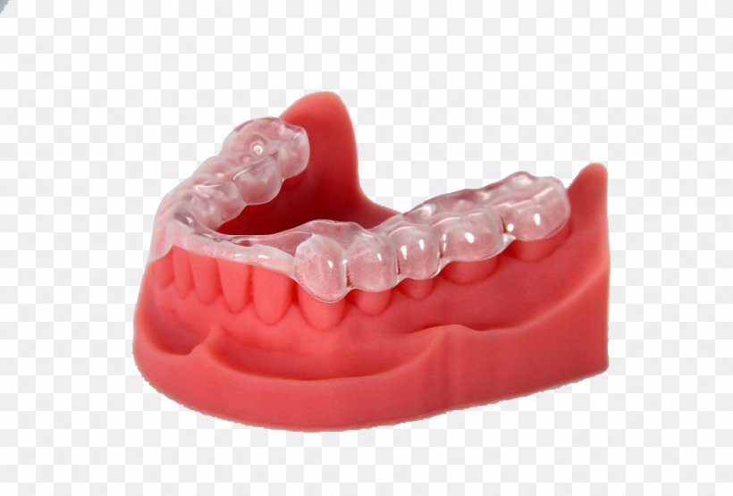 3D Printing Dentistry EnvisionTEC Printer, PNG, 1024x694px, 3d Printing, Acrylonitrile Butadiene Styrene, Crown, Dental Implant, Dentistry Download Free