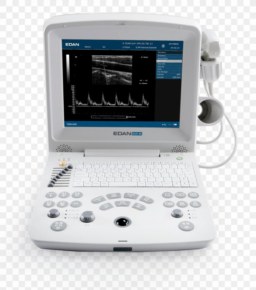 Ultrasonography Ultrasound Medical Imaging Electrocardiography Mindray, PNG, 1458x1652px, Ultrasonography, Display Device, Doppler Echocardiography, Doppler Fetal Monitor, Electrocardiography Download Free