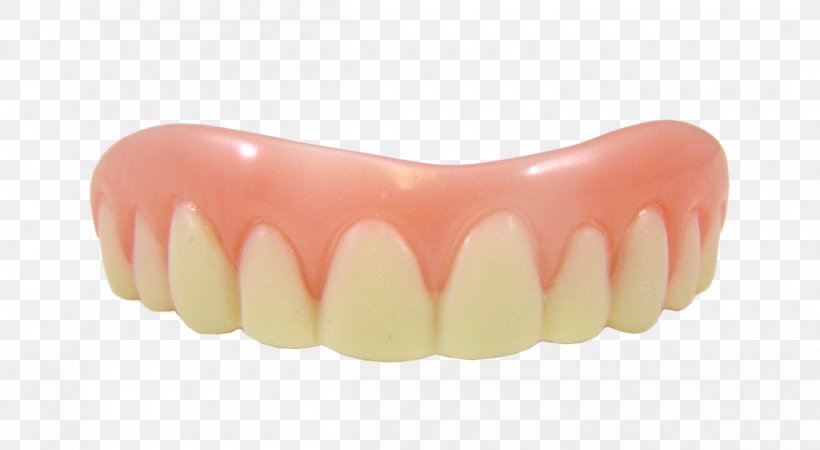Veneer Dentures Dentistry Tooth Cosmetics, PNG, 1200x659px, Veneer, Bad Breath, Cosmetic Dentistry, Cosmetics, Dental Restoration Download Free