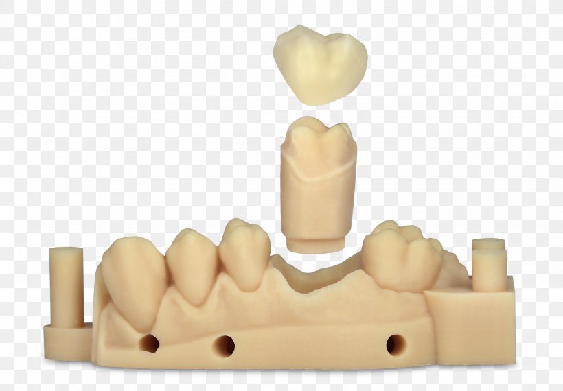 Dentistry EnvisionTEC 3D Printing Crown, PNG, 2048x1424px, 3d Printing, Dentistry, Crown, Dental Explorer, Dental Implant Download Free