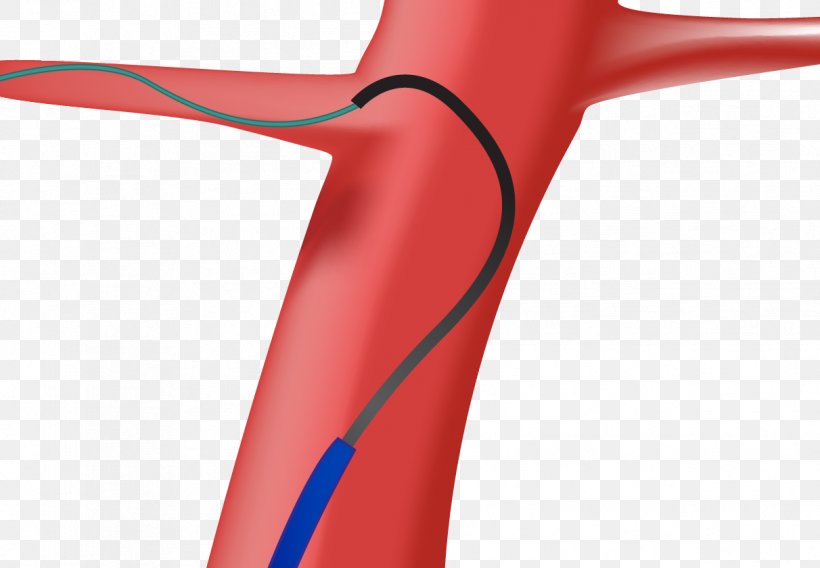 Line Shoulder Angle, PNG, 1212x841px, Shoulder, Bicycle, Bicycle Part, Human Leg, Joint Download Free