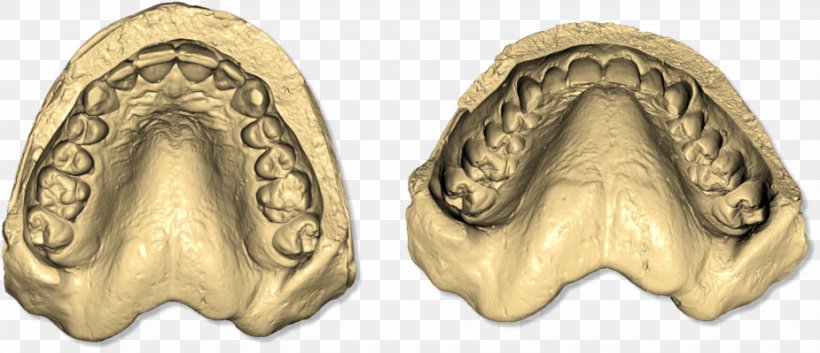 Dental Impression Dentistry Image Scanner Dental Implant Tooth, PNG, 925x399px, 3d Scanner, Dental Impression, Abutment, Body Jewelry, Computer Software Download Free