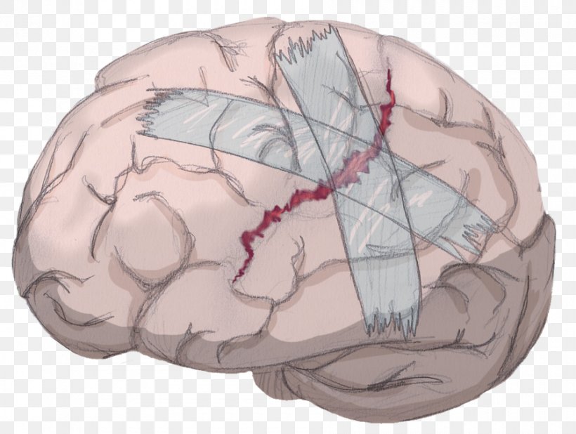 Brain Neuroimaging TV Tropes Mind Head, PNG, 900x679px, Watercolor, Cartoon, Flower, Frame, Heart Download Free