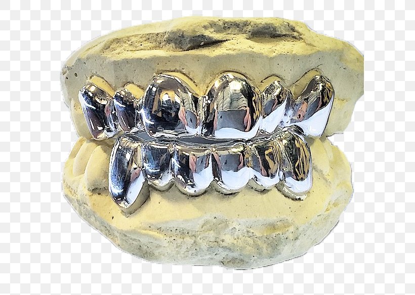 Grillz Human Tooth Smile Jaw, PNG, 630x583px, Grillz, Dentist, Face, Gold, Gold Teeth Download Free