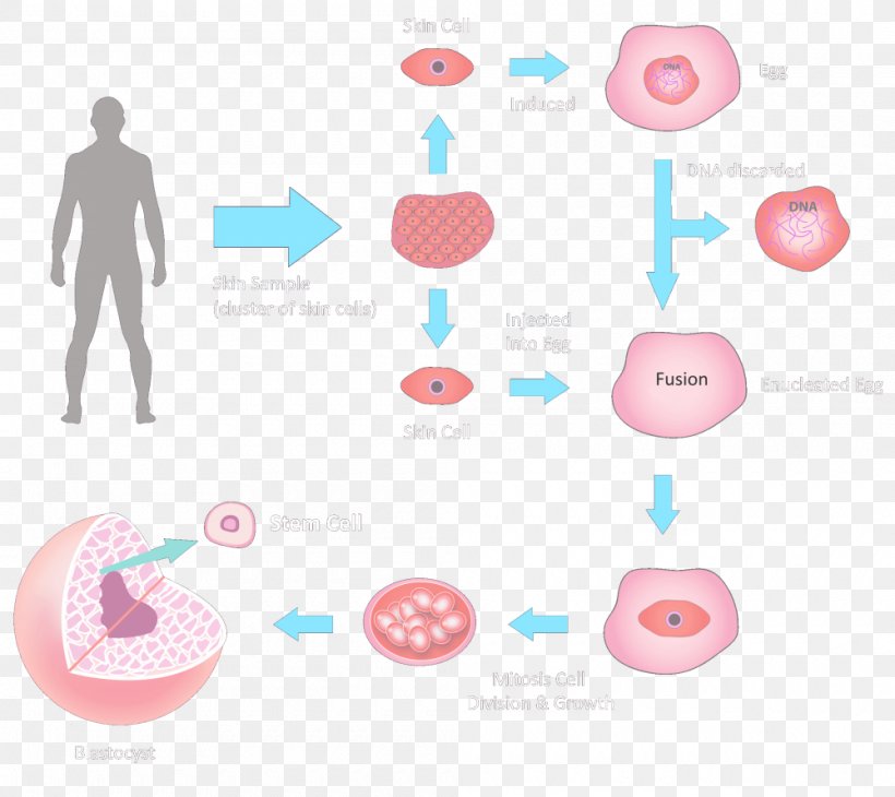 Embryonic Stem Cell Stem-cell Therapy, PNG, 1000x891px, Stem Cell, Blastocyst, Cell, Cell Therapy, Cell Type Download Free