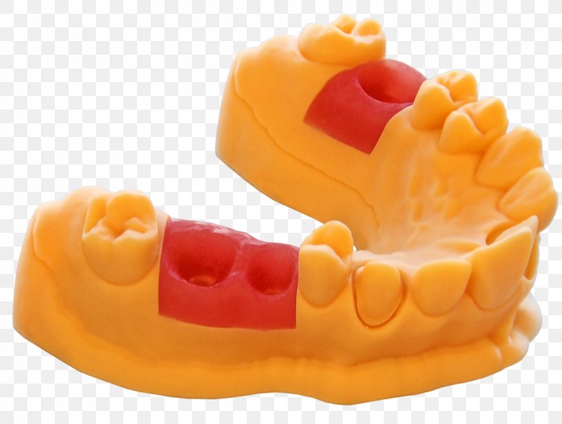 3D Printing Dentistry Printer EnvisionTEC, PNG, 1138x860px, 3d Printing, Dental Laboratory, Dental Prosthesis, Dentist, Dentistry Download Free