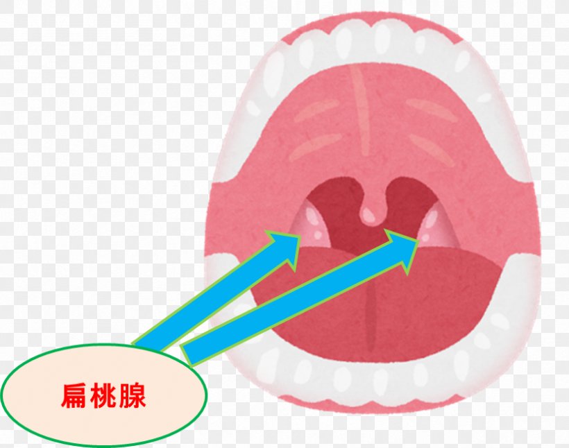 Mouth Tonsil Throat Pharynx Therapy, PNG, 833x657px, Mouth, Bad Breath, Disease, Eating, Jaw Download Free