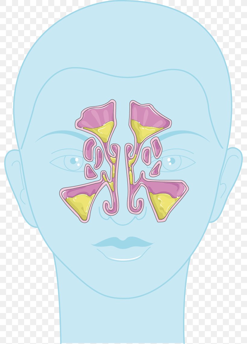 Nose Sinus Infection Child Chronic Condition Swelling, PNG, 792x1143px, Watercolor, Cartoon, Flower, Frame, Heart Download Free