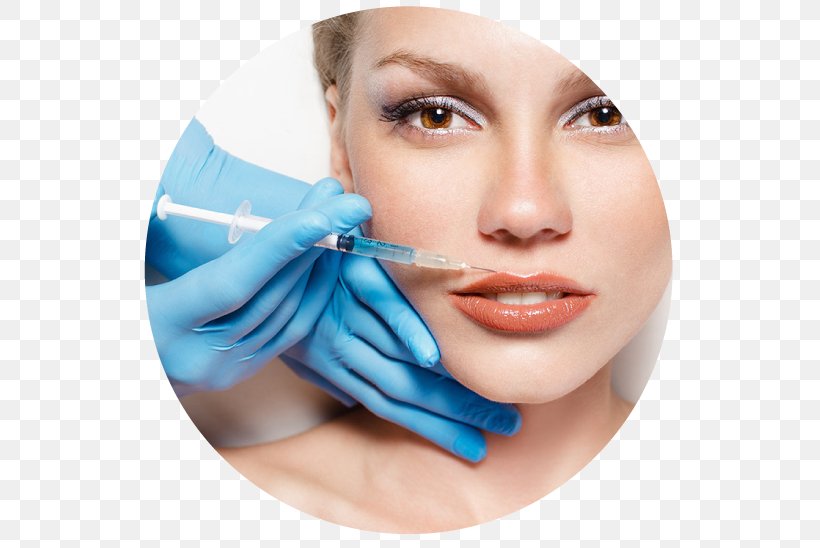 Plastic Surgery Botulinum Toxin Medicine Surgeon, PNG, 544x548px, Surgery, Beauty, Botulinum Toxin, Cheek, Chin Download Free