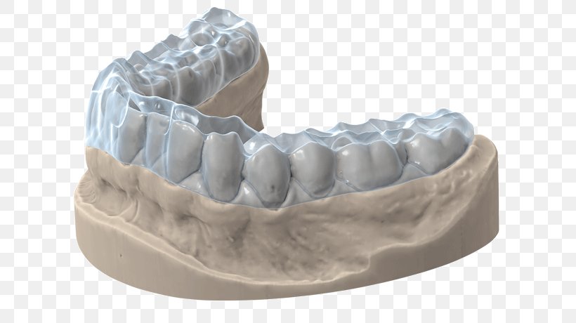 3D Scanner Tooth Computer Software Image Scanner 3D Printing, PNG, 750x460px, 3d Printing, 3d Scanner, Articulator, Cadcam Dentistry, Cadstar Download Free