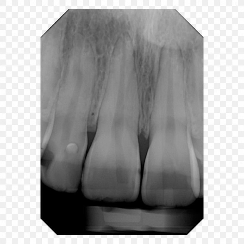 Digital Radiography X-ray Dental Radiography Cone Beam Computed Tomography, PNG, 1024x1024px, Digital Radiography, Black And White, Cone Beam Computed Tomography, Dental Radiography, Dentist Download Free