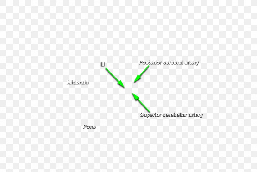 Brand Line Diagram, PNG, 1195x800px, Brand, Area, Diagram, Green, Text Download Free