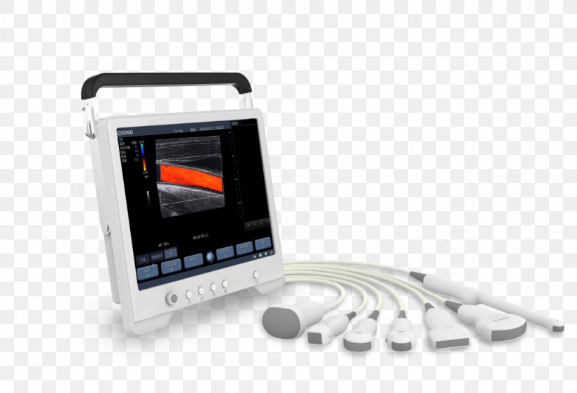 Dog Ultrasonography Doppler Echocardiography Medical Imaging Ultrasound, PNG, 1024x698px, Dog, Abdominal Ultrasonography, Cardiology, Doppler Echocardiography, Echocardiography Download Free