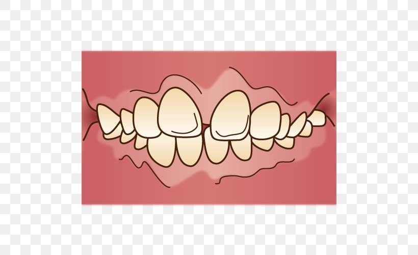 Tooth 矯正歯科 Dentist Dental Braces, PNG, 500x500px, Watercolor, Cartoon, Flower, Frame, Heart Download Free