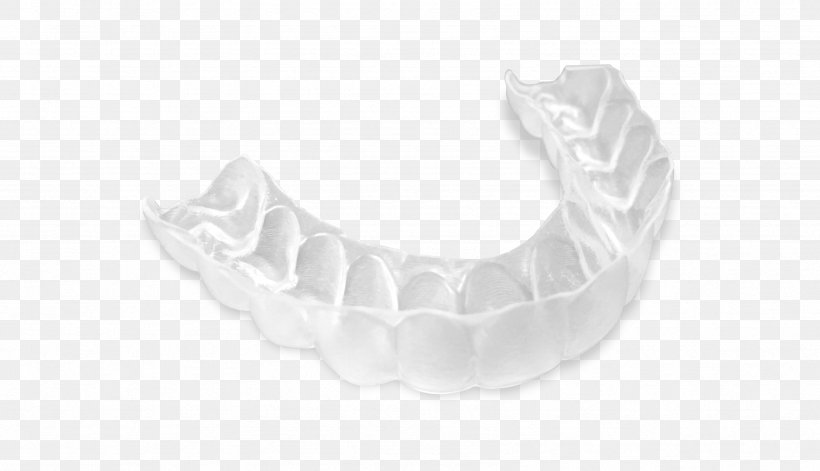 Silver Jaw Angle, PNG, 3381x1946px, Silver, Jaw, White Download Free