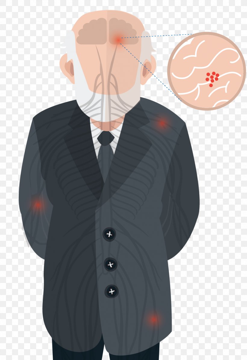 Parkinson Disease Dementia Doença De Parkinson La Enfermedad De Parkinson Parkinsonism, PNG, 1120x1634px, Parkinson Disease Dementia, Central Nervous System, Clothing, Disease, Gentleman Download Free