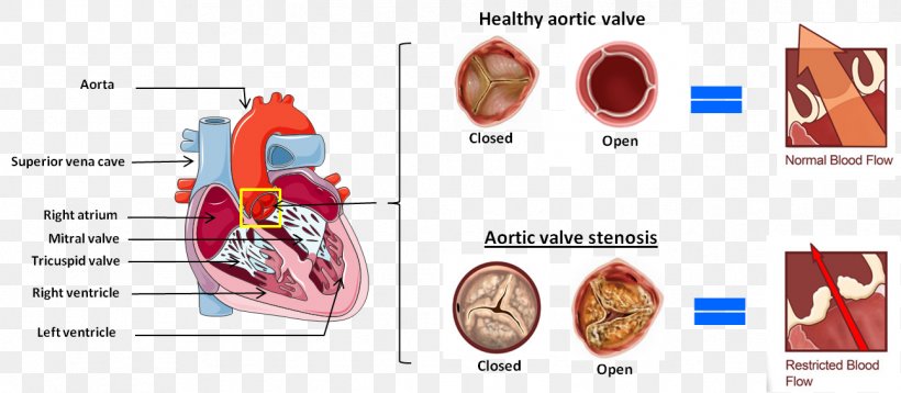 Muscle Heart Homo Sapiens, PNG, 1293x566px, Watercolor, Cartoon, Flower, Frame, Heart Download Free