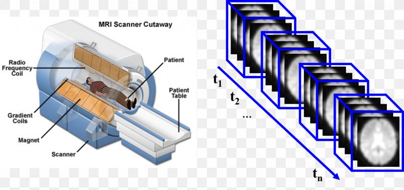 Magnetic Resonance Imaging Medical Imaging Computed Tomography MRI-scanner Radiology, PNG, 1602x753px, Magnetic Resonance Imaging, Brain Tumor, Computed Tomography, Computer Network, Diagram Download Free