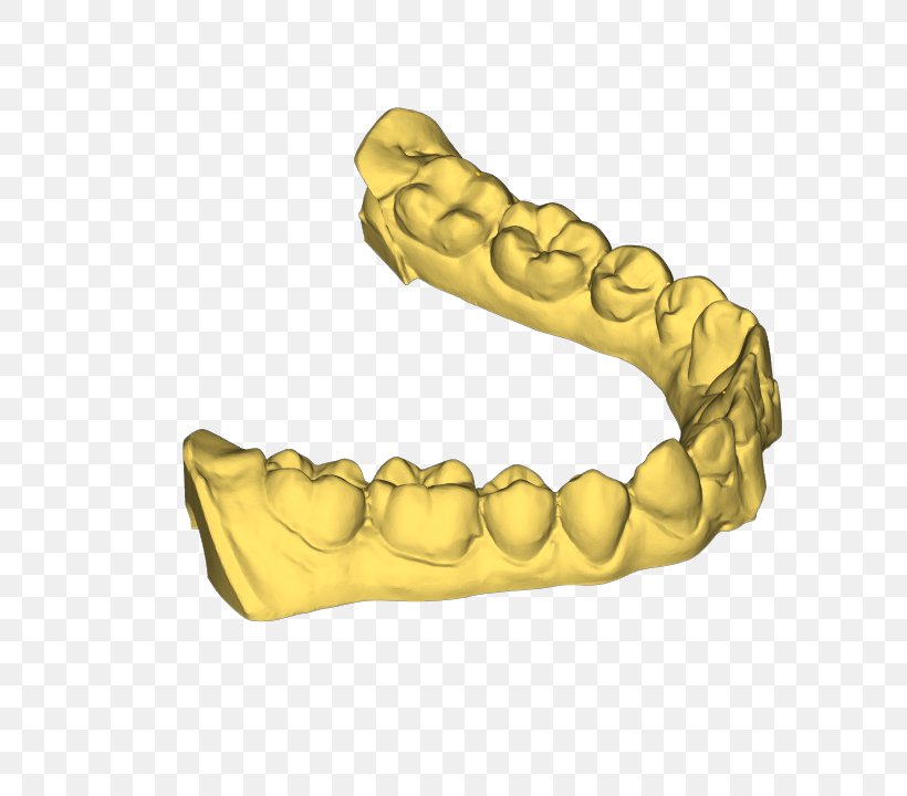 3D Printing Printer Dental Arch Dentistry, PNG, 720x720px, 3d Computer Graphics, 3d Printing, Arch, Dental Arch, Dentistry Download Free