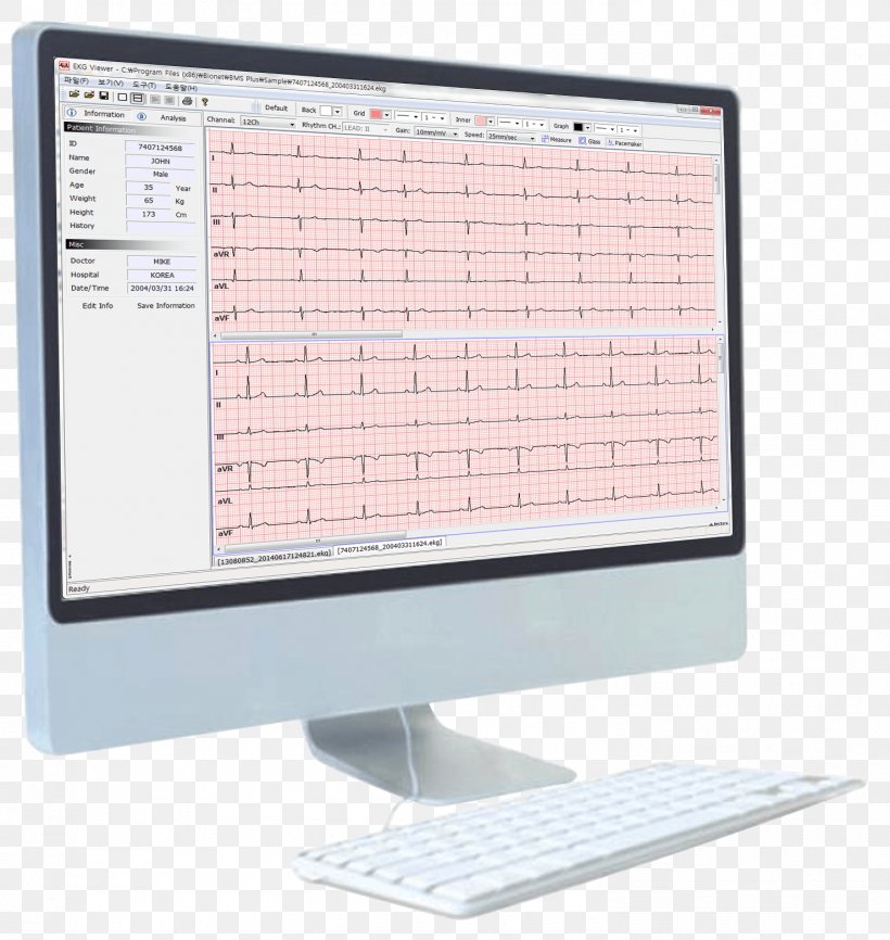 Artun Medikal Teknik Servis Electrocardiography Spirometer Pulmonary Function Testing Vital Capacity, PNG, 1479x1563px, Electrocardiography, Aerobic Exercise, Bronchodilator, Lung, Product Manuals Download Free