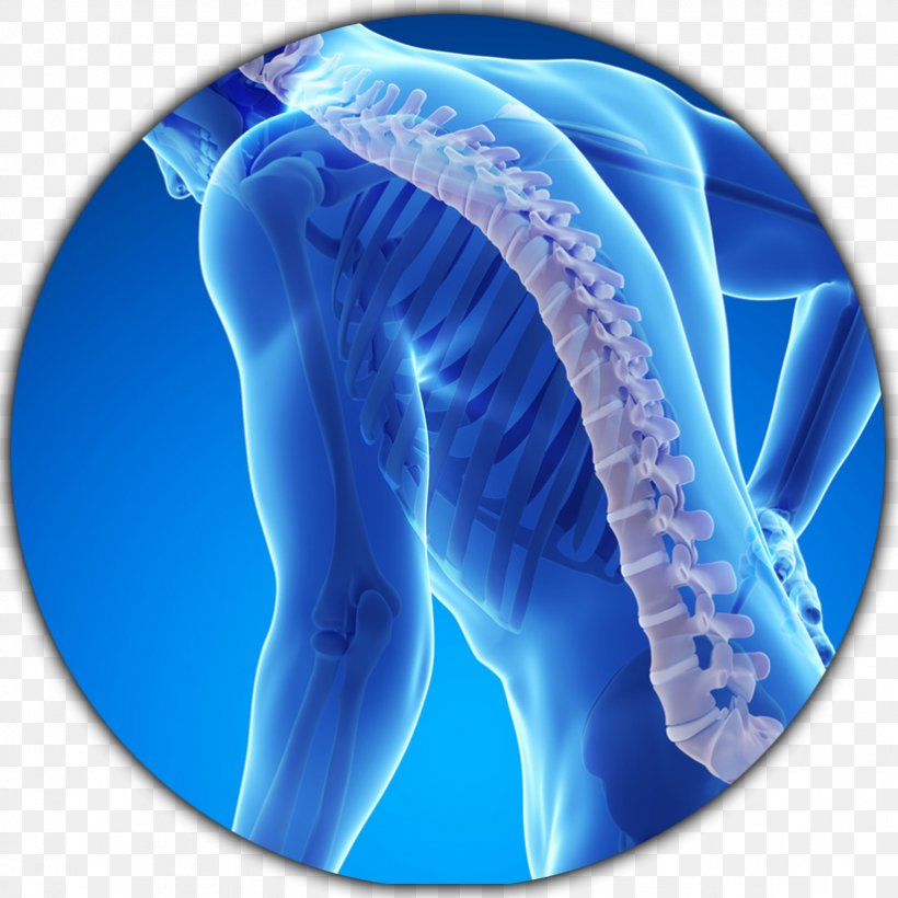 Osteoporosis Bone Fracture Disease Bone Density Health, PNG, 822x822px, Osteoporosis, Ache, Ankylosing Spondylitis, Bone, Bone Density Download Free