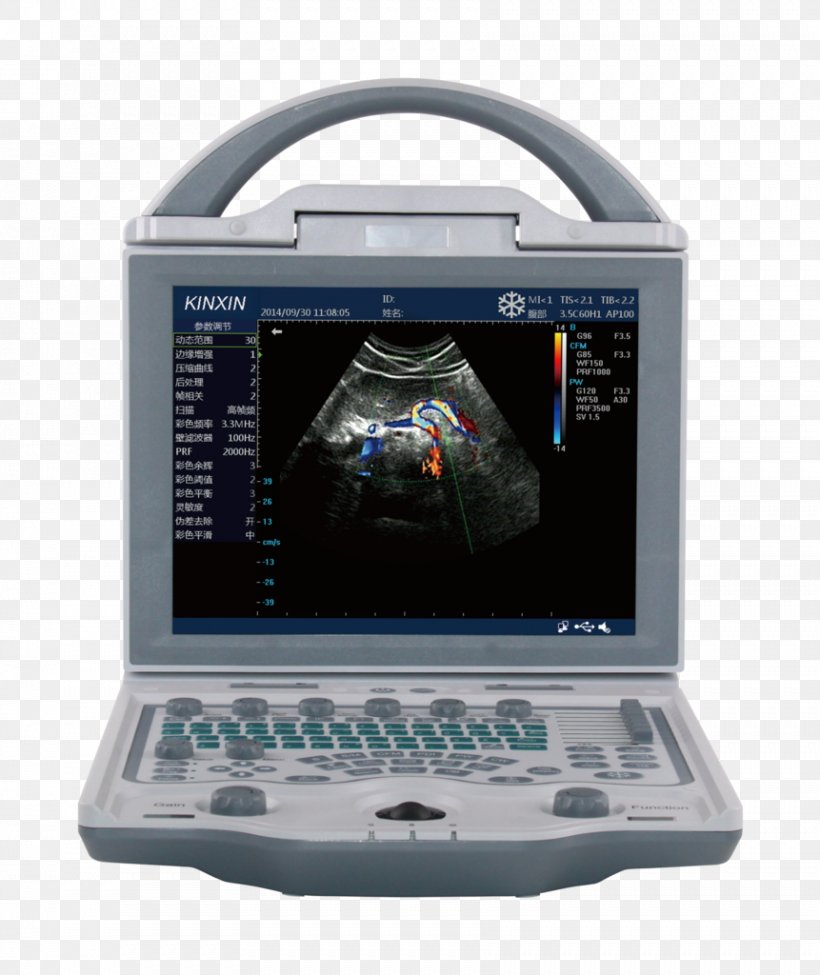 Ultrasonography Ophthalmology Equine Ultrasound Doppler Echocardiography, PNG, 861x1024px, Ultrasonography, Animal, Corneal Pachymetry, Display Device, Doppler Echocardiography Download Free