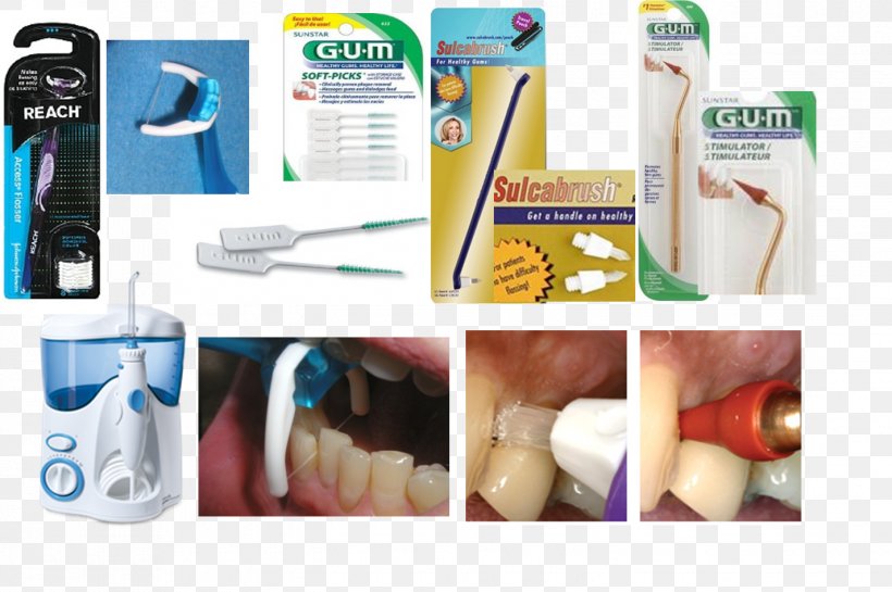 Toothbrush Dental Floss Dental Water Jets Toothpick Dentistry, PNG, 1425x948px, Toothbrush, Bridge, Brush, Dental Braces, Dental Floss Download Free