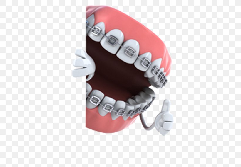 Dentistry Orthodontics Dental Braces Tooth Medicine, PNG, 586x570px, Dentistry, Clinic, Cosmetic Dentistry, Dental Braces, Dental Extraction Download Free