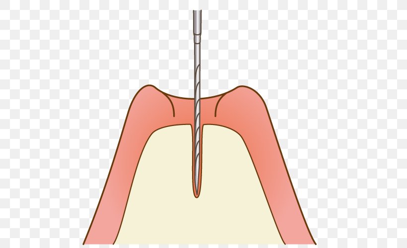 Sinus Lift Maxillary Sinus Dental Implant Paranasal Sinuses Bone, PNG, 500x500px, Watercolor, Cartoon, Flower, Frame, Heart Download Free