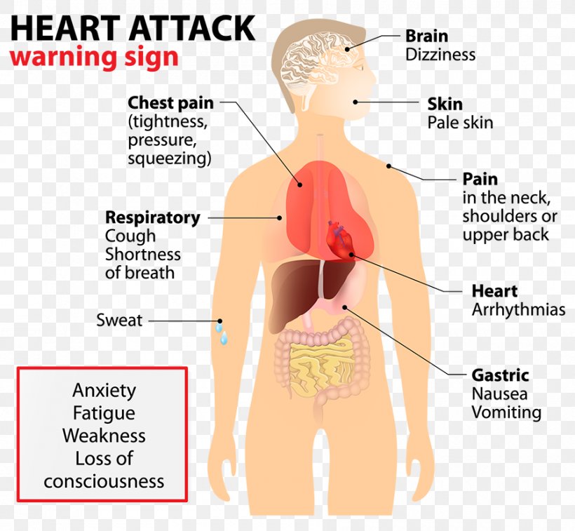 Acute Myocardial Infarction Heart Cardiovascular Disease Health, PNG, 900x831px, Watercolor, Cartoon, Flower, Frame, Heart Download Free
