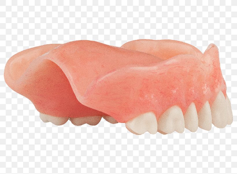 Tooth Dentures Dentistry Jaw Dental Implant, PNG, 800x602px, Tooth, Aspen Dental, Bone, Bone Density, Cosmetic Dentistry Download Free